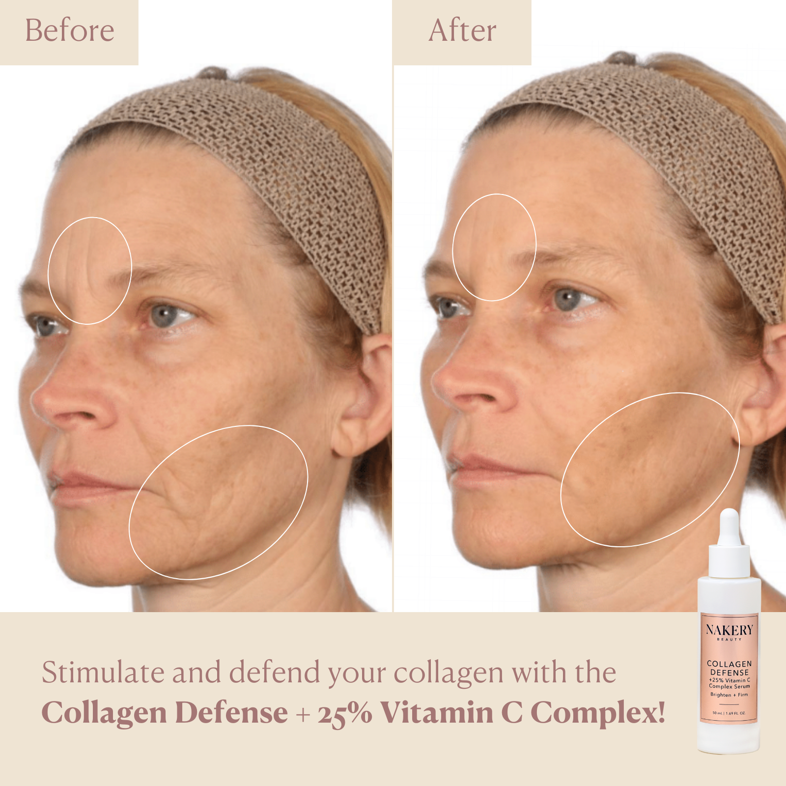 CollagenDefense - Nakery Beauty