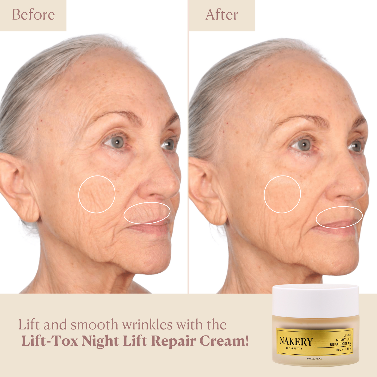 lift-tox-night-lift-repair-cream before and after