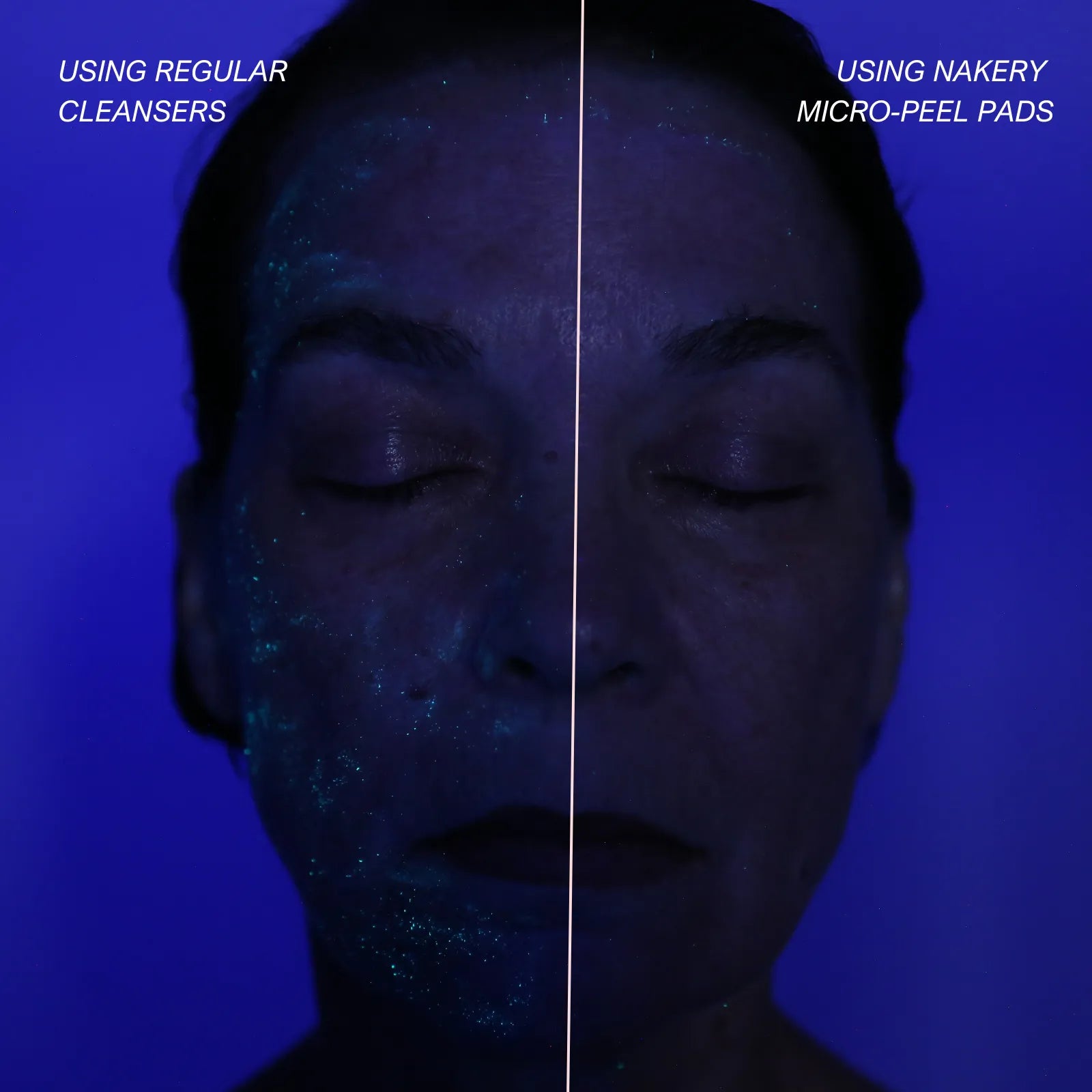 MicropeelPads - Nakery Beauty