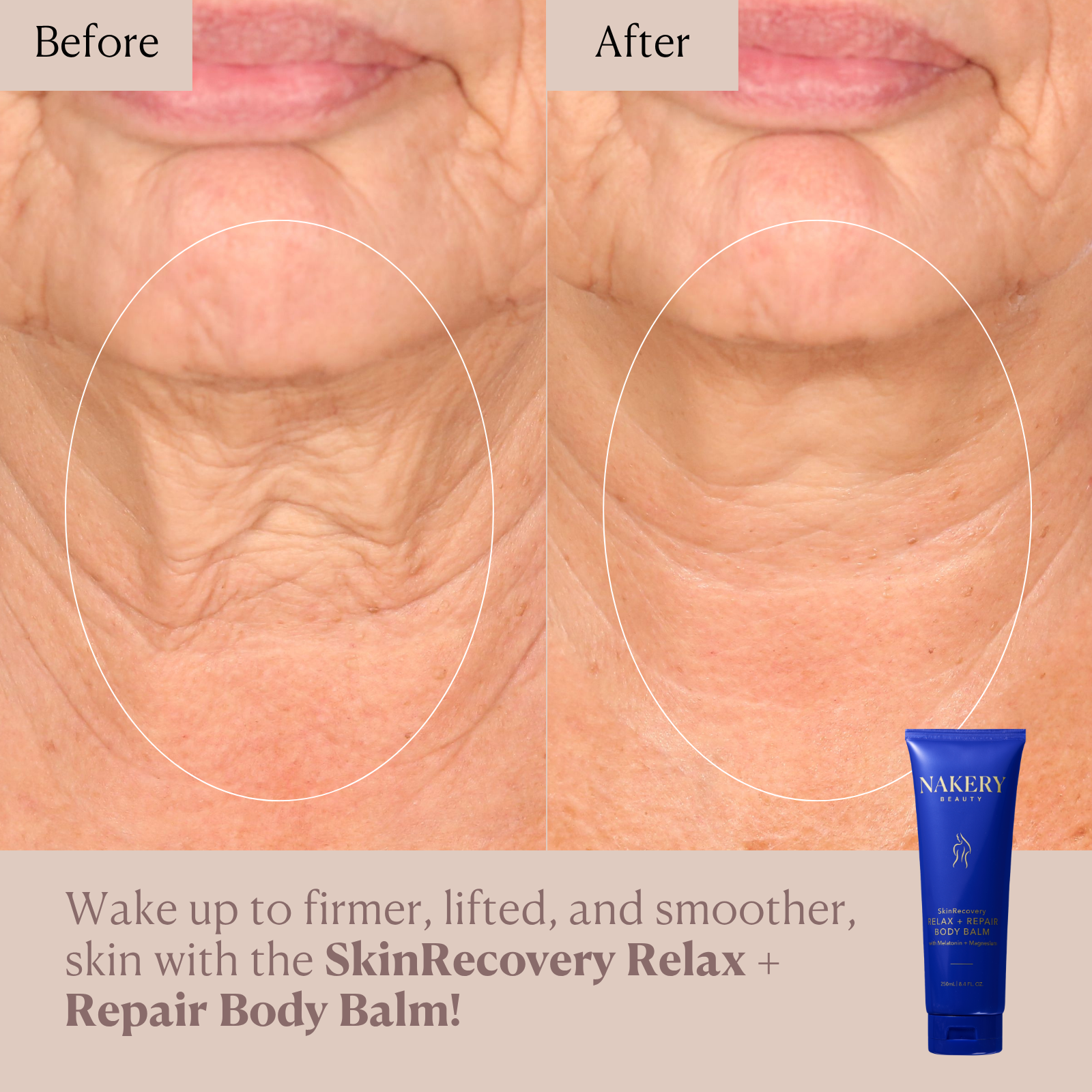SkinRecovery Relax + Repair Body Balm with Magnesium + Melatonin (250 mL)