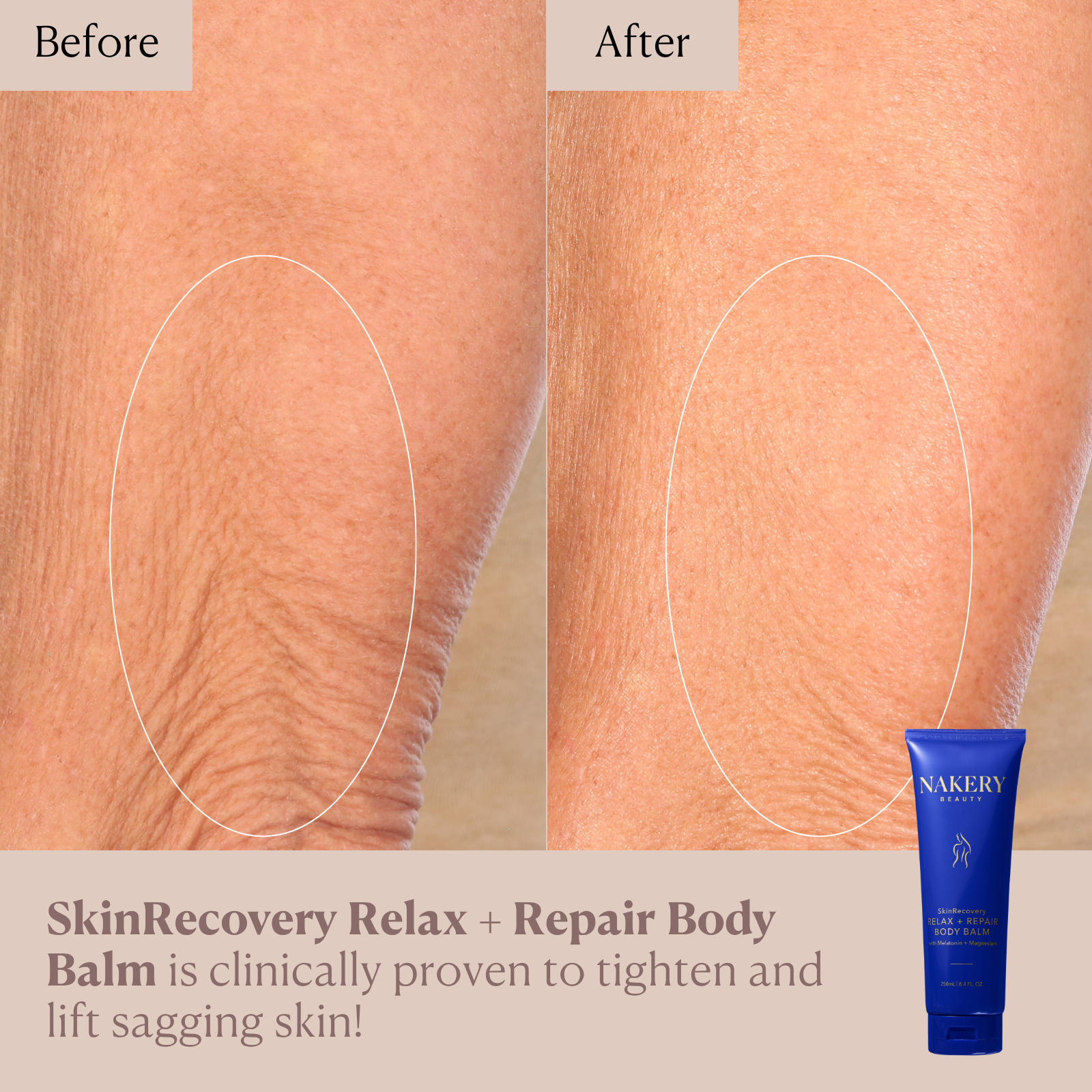 SkinRecovery Relax + Repair Body Balm with Magnesium + Melatonin (250 mL)