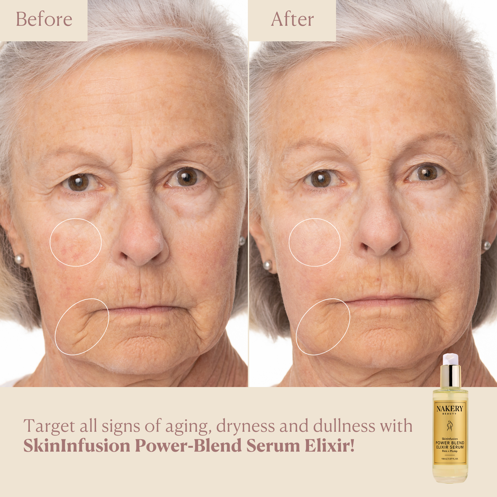 SkinInfusion
