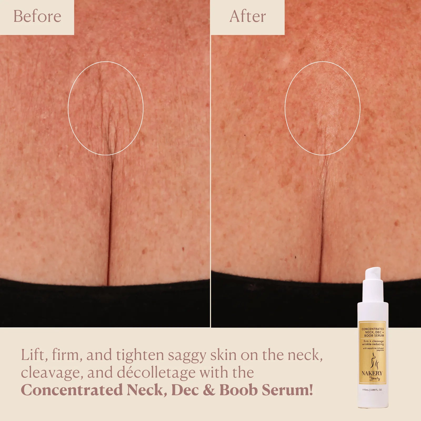 Embrace the Ladies Concentrated Firming Neck, Dec & Boob Serum - Nakery Beauty