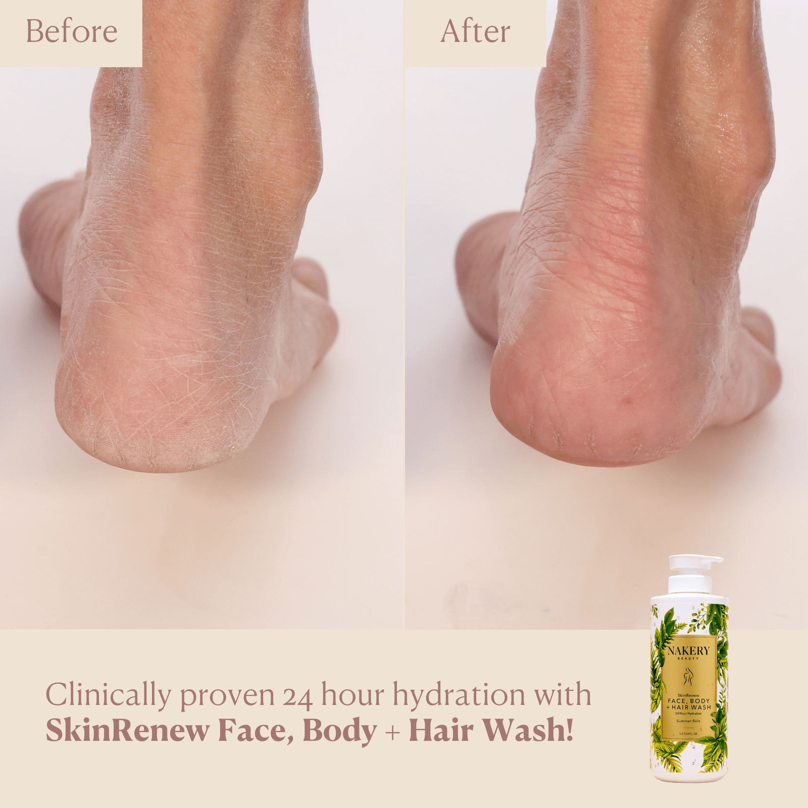 SkinRenew Face, Body + Hair Wash