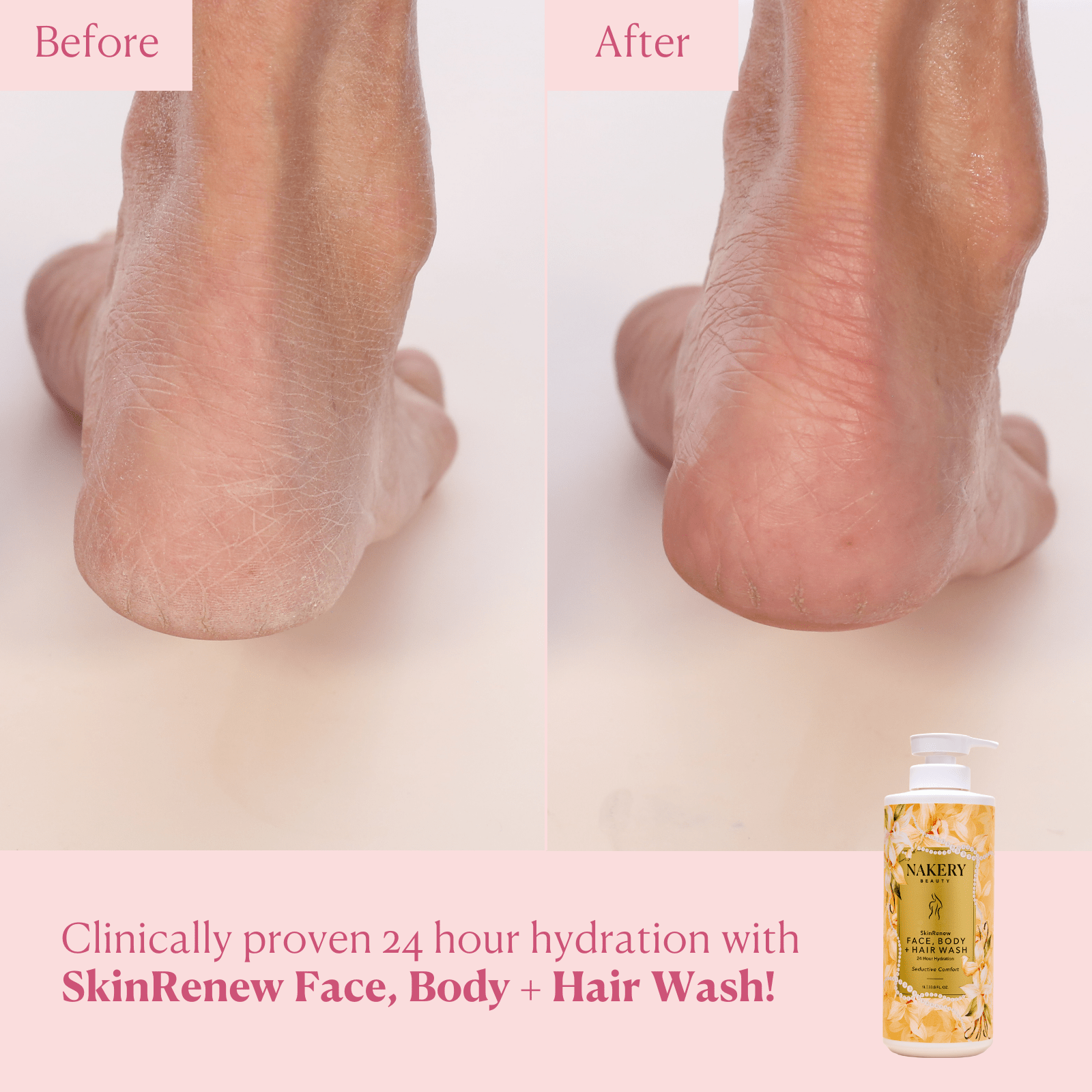 SkinRenew Face, Body + Hair Wash