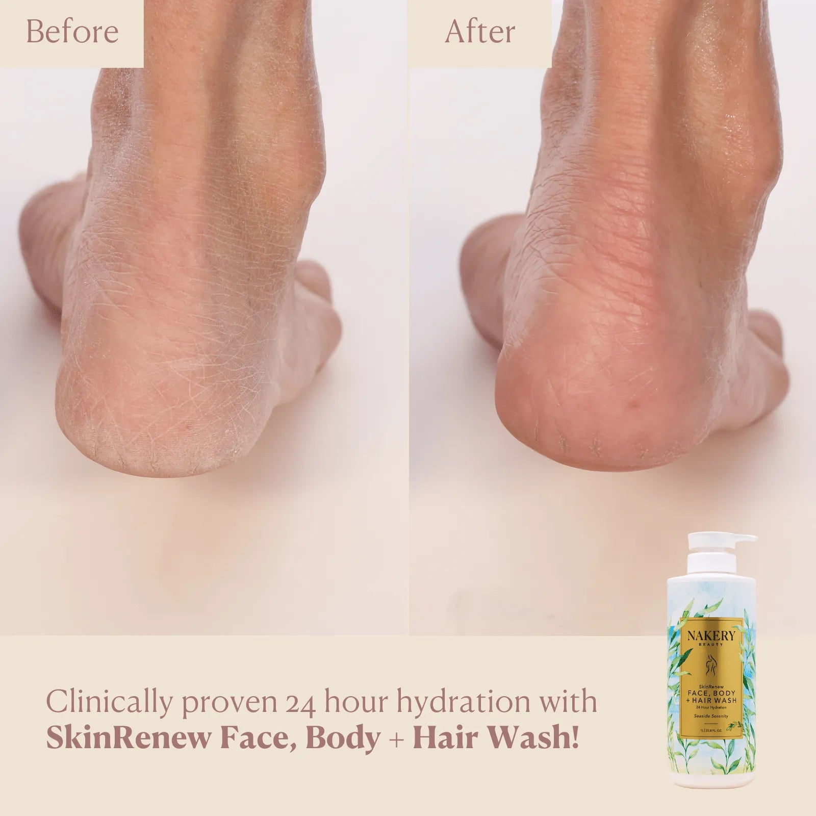 SkinRenew Face, Body + Hair Wash
