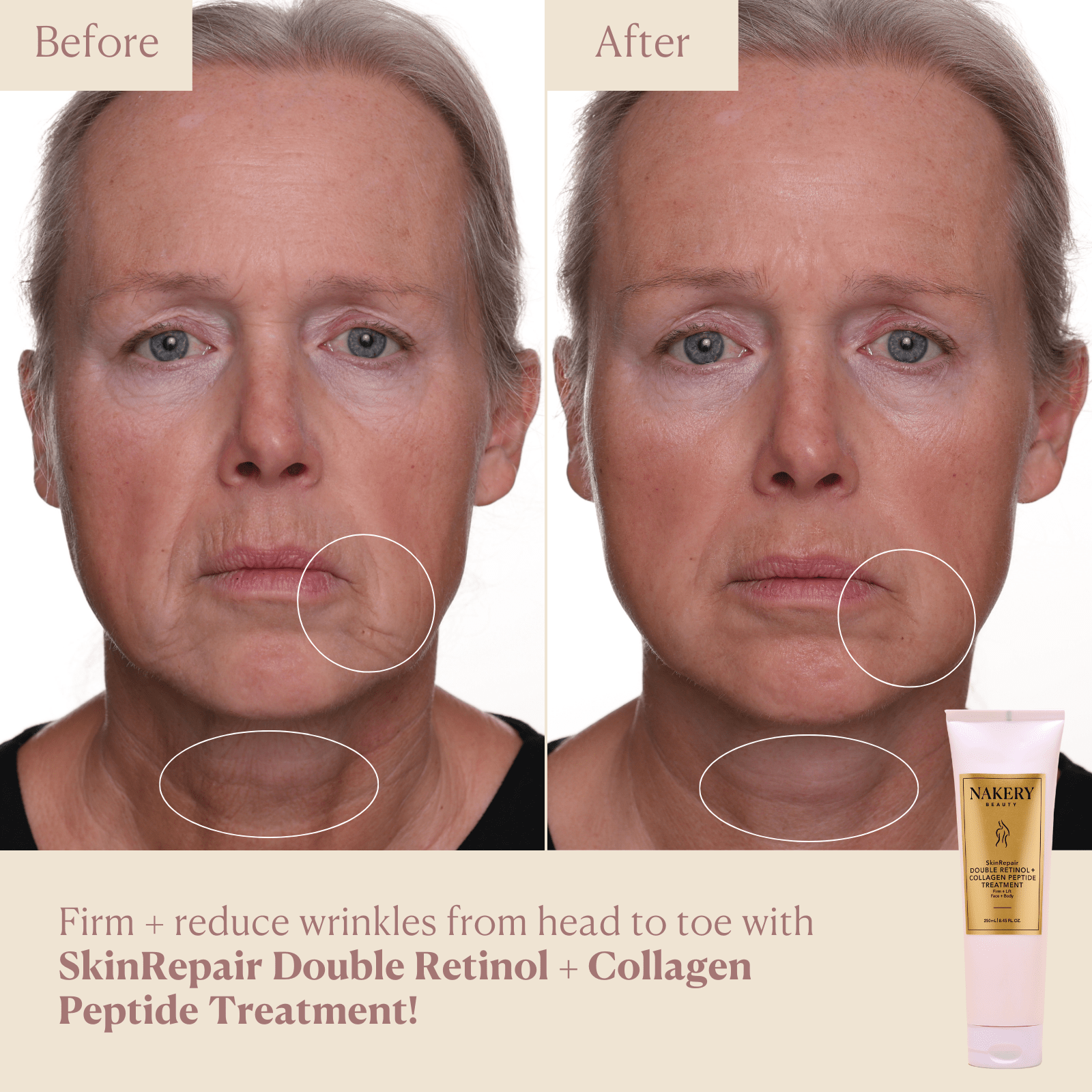 SkinRepair Double Retinol + Collagen Face & Body Treatment - Nakery Beauty