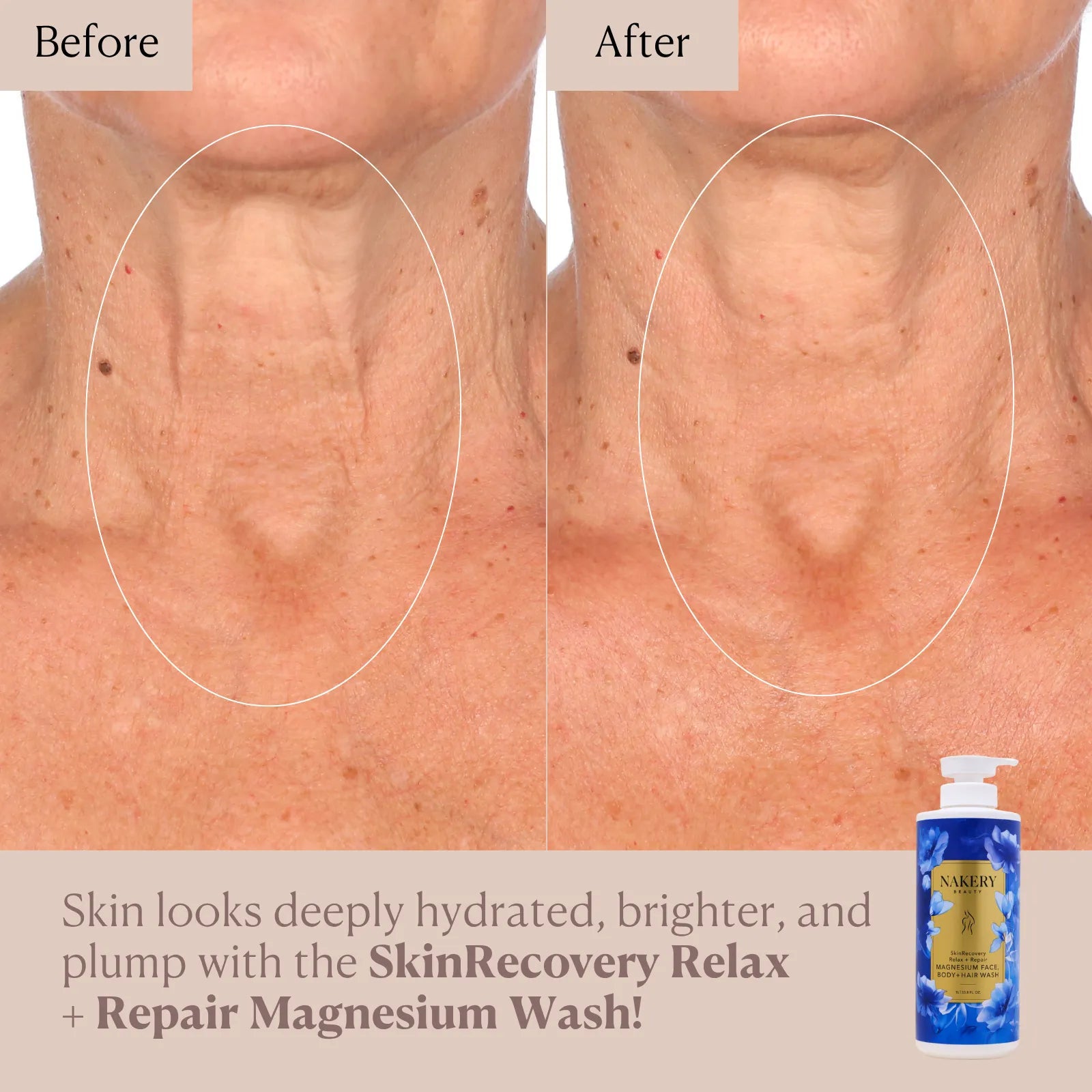 SkinRecovery Relax + Repair Magnesium Face, Body, &amp; Hair Wash