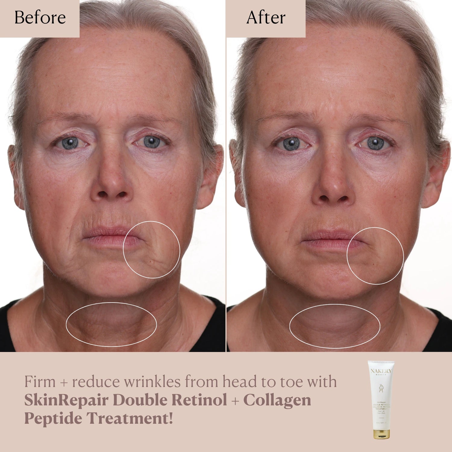 SkinRepair Double Retinol + Collagen Face &amp; Body Treatment