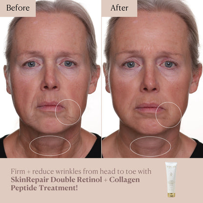 SkinRepair Double Retinol + Collagen Face &amp; Body Treatment