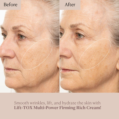 Lift-TOX Multi-Power Firming Rich Cream TRIPLE SIZE