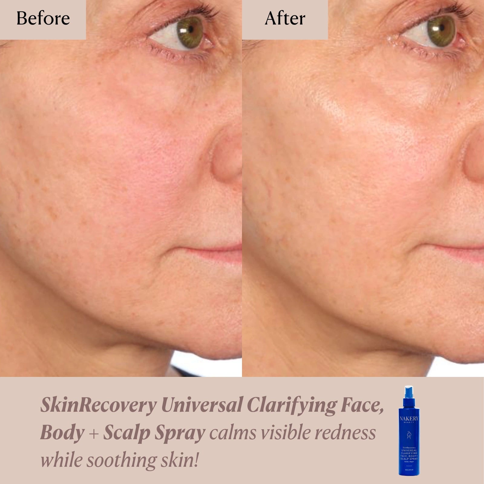 SkinRecovery Universal Clarifying Face, Body + Scalp Spray