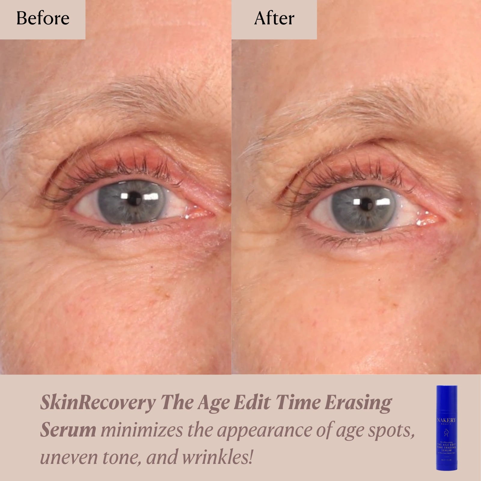 SkinRecovery The Age Edit: Time Erasing Serum