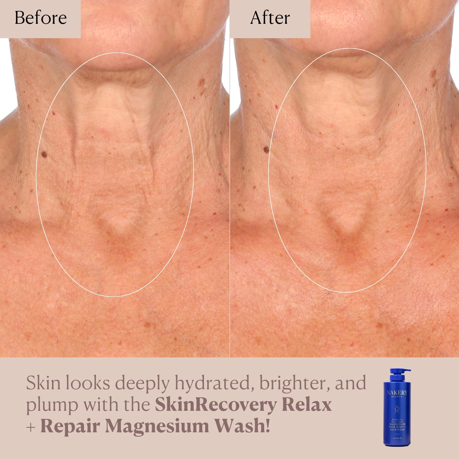 SkinRecovery Relax + Repair Magnesium Face, Body, &amp; Hair Wash