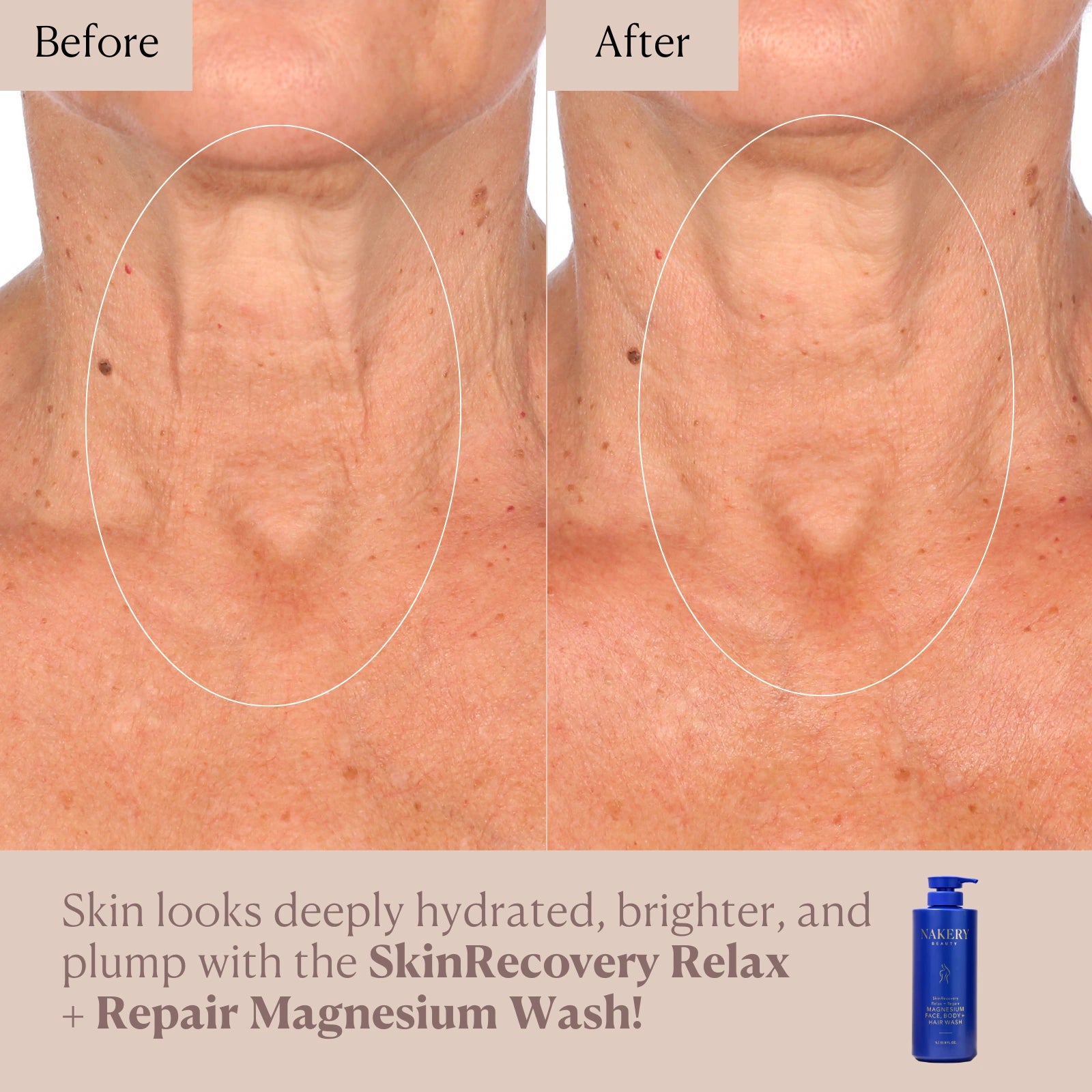 SkinRecovery Relax + Repair Magnesium Face, Body, &amp; Hair Wash