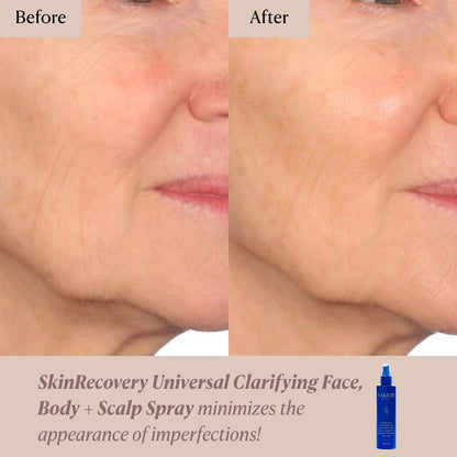 SkinRecovery Universal Clarifying Face, Body + Scalp Spray