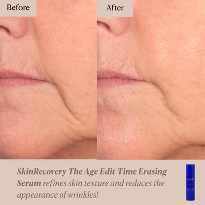 SkinRecovery The Age Edit: Time Erasing Serum