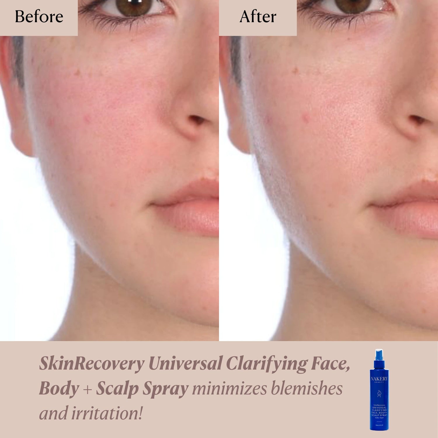 SkinRecovery Universal Clarifying Face, Body + Scalp Spray