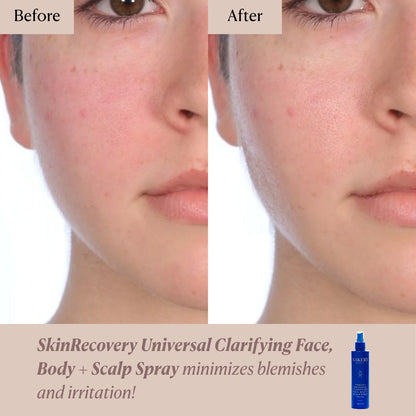 SkinRecovery Universal Clarifying Face, Body + Scalp Spray