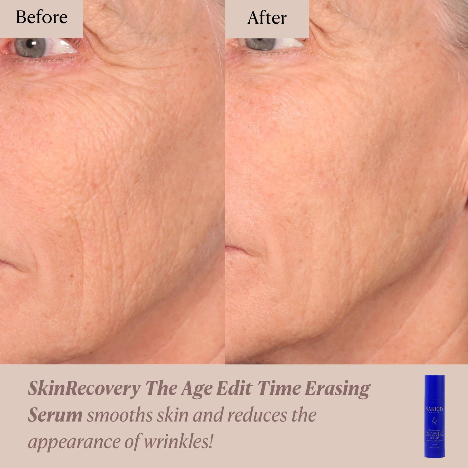 SkinRecovery The Age Edit: Time Erasing Serum