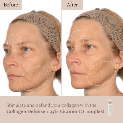 Collagen Defense + 25% Vitamin C Complex Serum