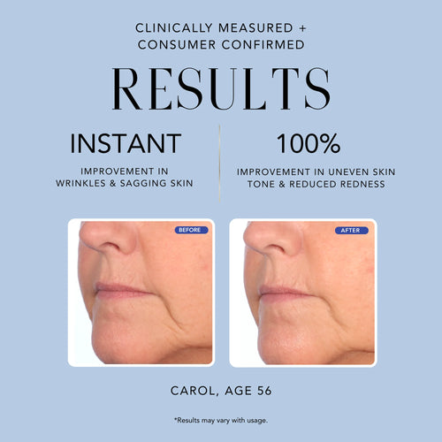 Before-and-after skin comparison for Nakery Beauty The Age Edit Time Erasing Serum showing improvements in wrinkles, sagging, uneven skin tone, and redness.