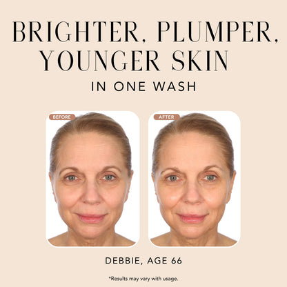 Before-and-after comparison of a woman after using Nakery Beauty Instant Reset Collagen Cleanser, showing brighter, plumper, younger-looking skin after one wash.
