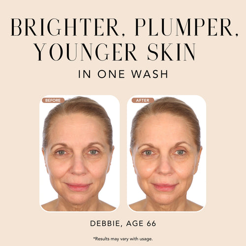 Before-and-after comparison of a woman after using Nakery Beauty Instant Reset Collagen Cleanser, showing brighter, plumper, younger-looking skin after one wash.