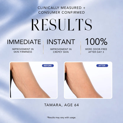 Before-and-after results for Nakery Beauty Cool + Energize Body Cream showing improved skin firmness and crepey skin, with 100% odor-free results after day three.