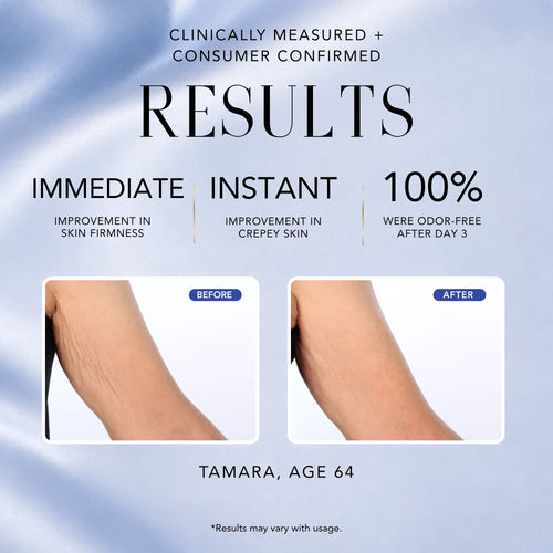 Before-and-after results for Nakery Beauty Cool + Energize Body Cream showing improved skin firmness and crepey skin, with 100% odor-free results after day three.