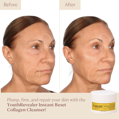 CollagenConcentrate - Nakery Beauty