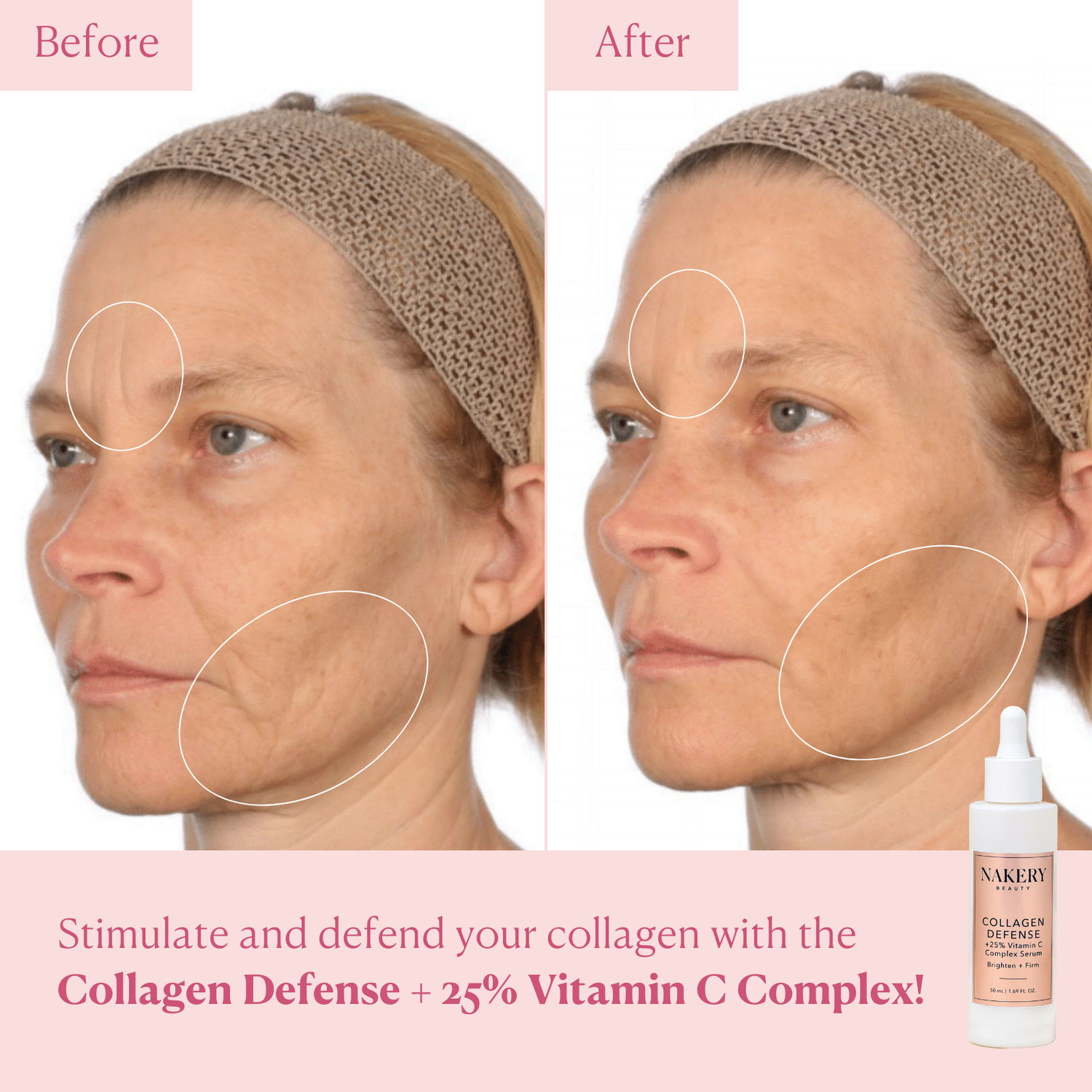 Collagen Defense + 25% Vitamin C Complex Serum