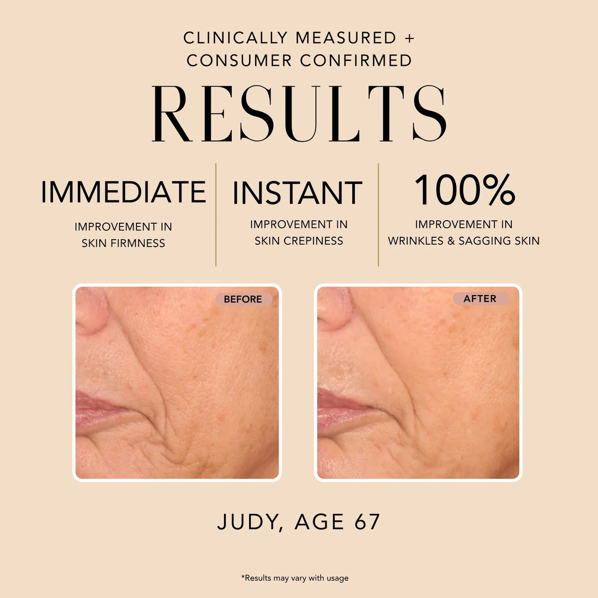 Before-and-after comparison of Judy, age 67, showing clinically measured improvement in skin firmness, crepiness, wrinkles, and sagging skin after using Nakery Lift-TOX Triple Powered Define + Firm Serum.