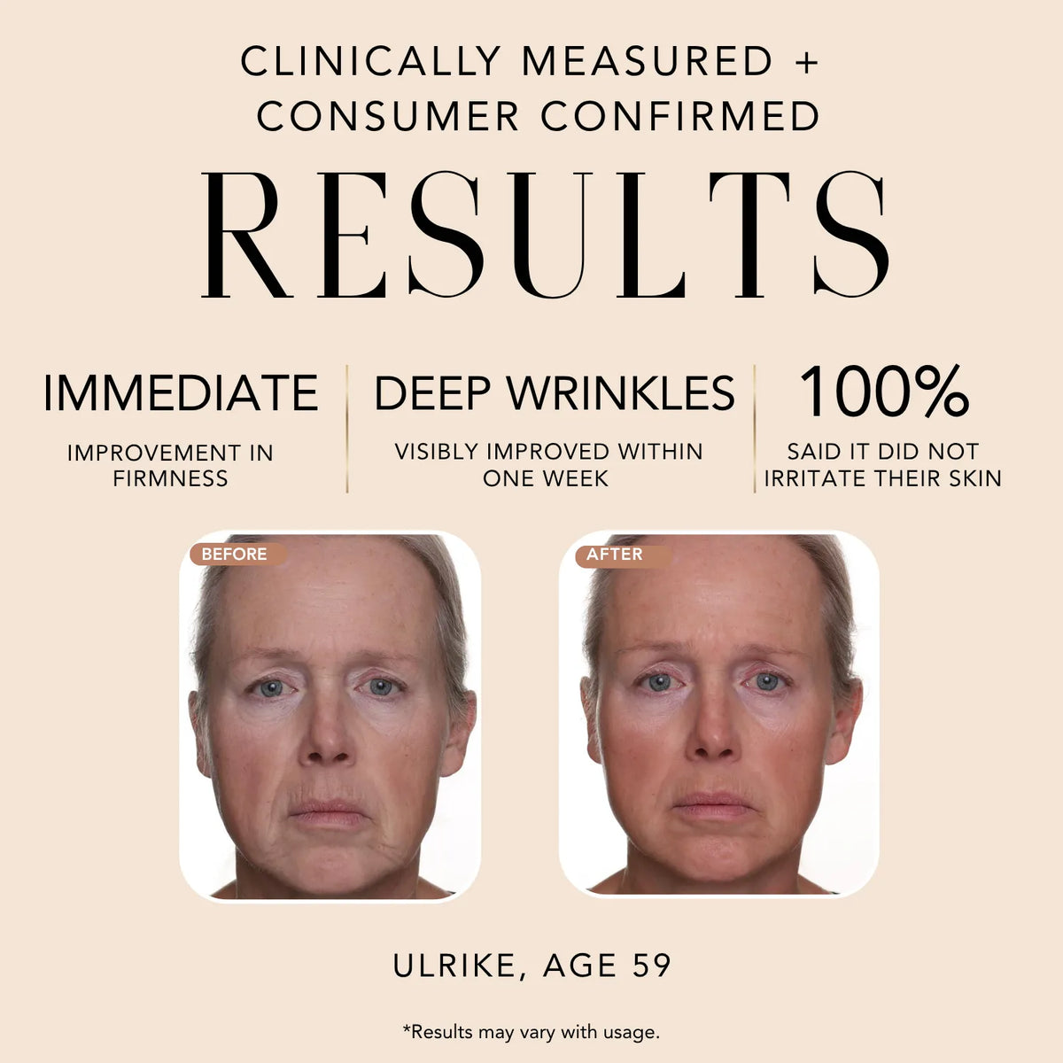 Before-and-after results for Nakery Beauty Double Retinol + Collagen Peptide Treatment showing improved firmness and the appearance of deep wrinkles after use.