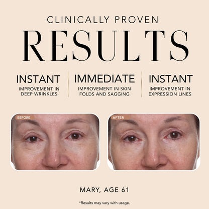 Before-and-after comparison for Nakery Beauty Retinol Deep Wrinkle Serum showing improvements in deep wrinkles, skin folds, sagging, and expression lines.