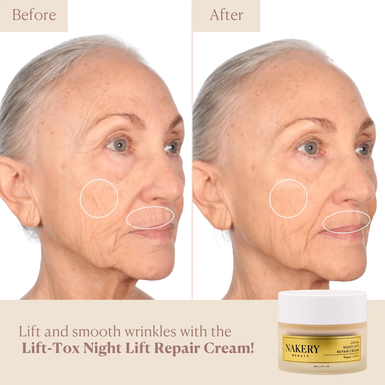lift-tox-night-lift-repair-cream before and after