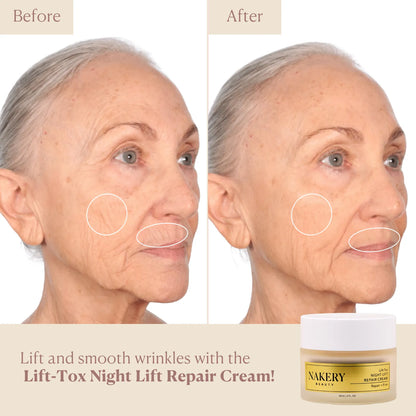 lift-tox-night-lift-repair-cream before and after