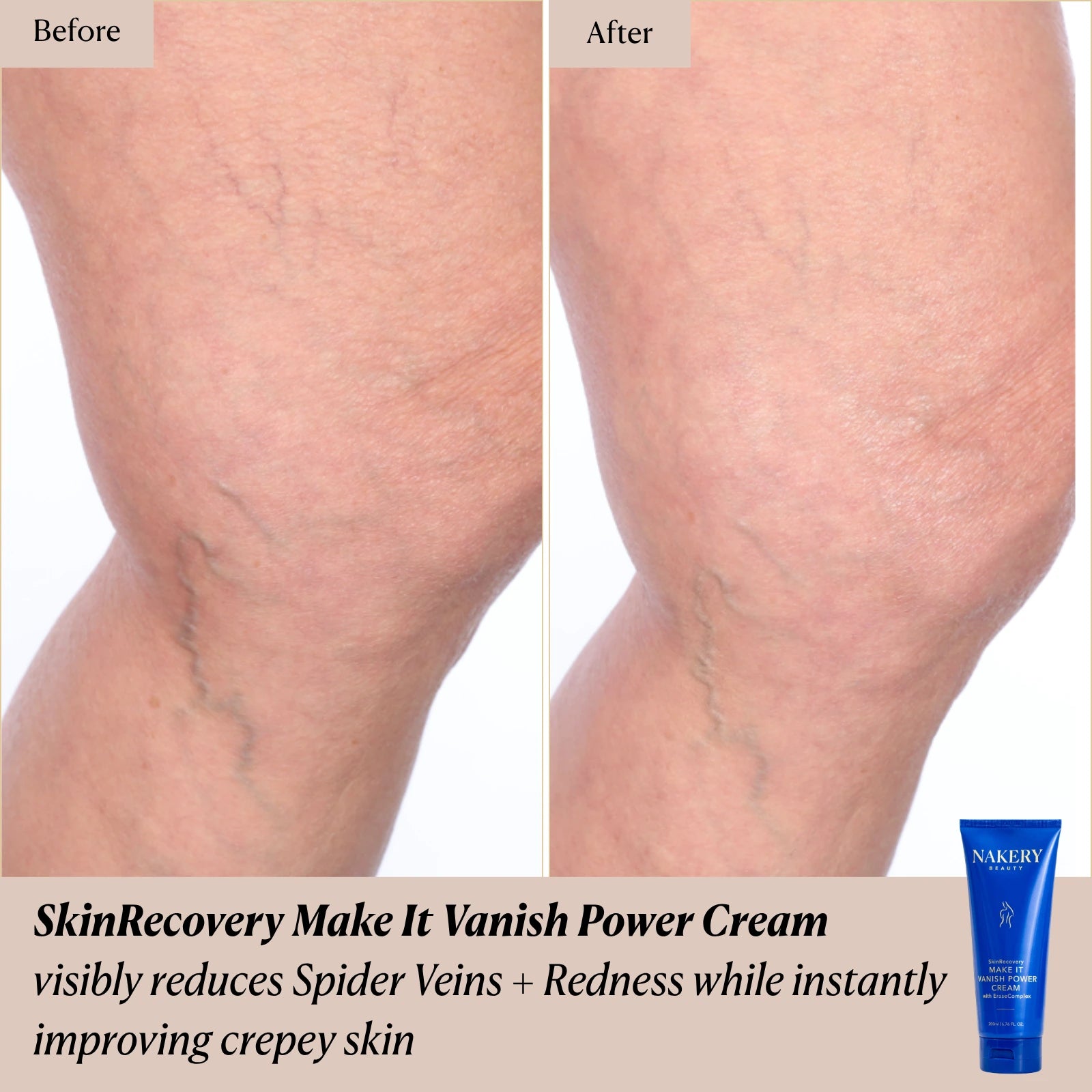 SkinRecovery Make It Vanish Power Cream with EraseComplex