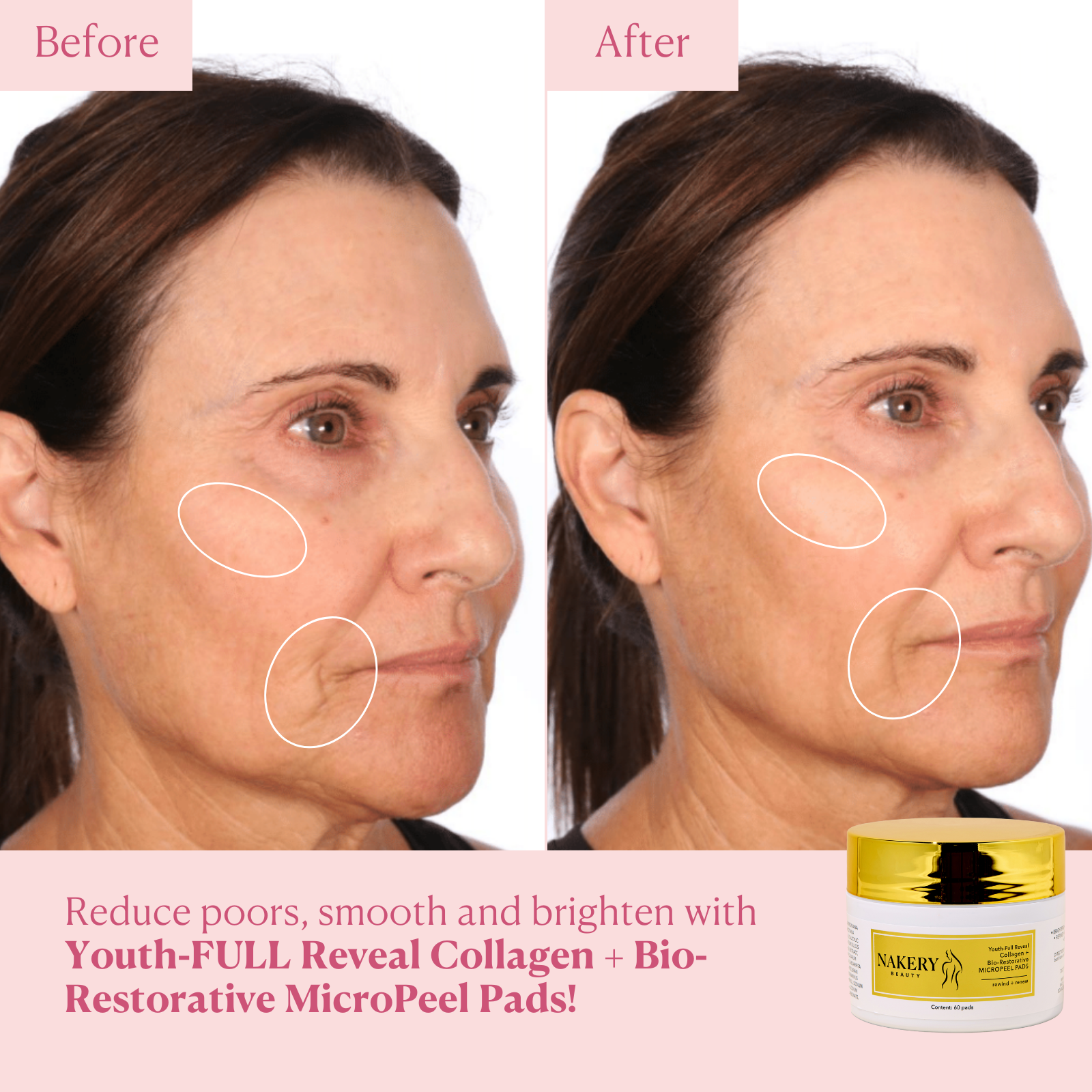 Youth-FULL Reveal Collagen + Bio-Restorative MicroPeel Pads