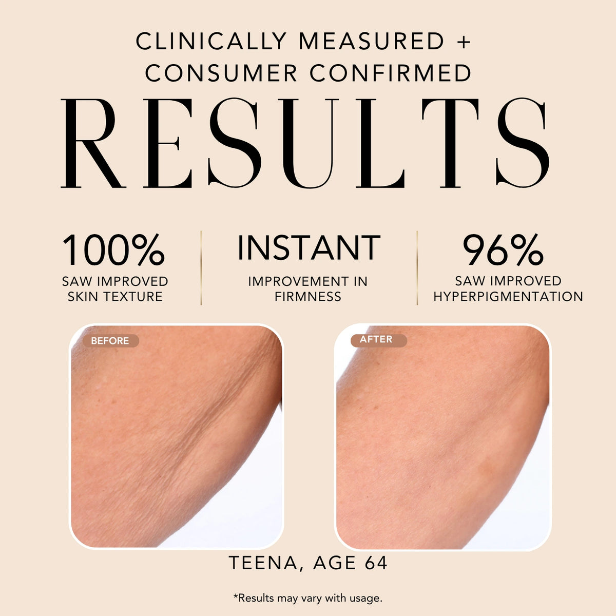 Before-and-after skin comparison for Nakery Beauty SkinReserve showing clinically measured improvements in skin texture, firmness, and hyperpigmentation.