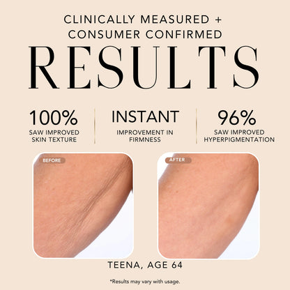 Before-and-after skin comparison for Nakery Beauty SkinReserve showing clinically measured improvements in skin texture, firmness, and hyperpigmentation.