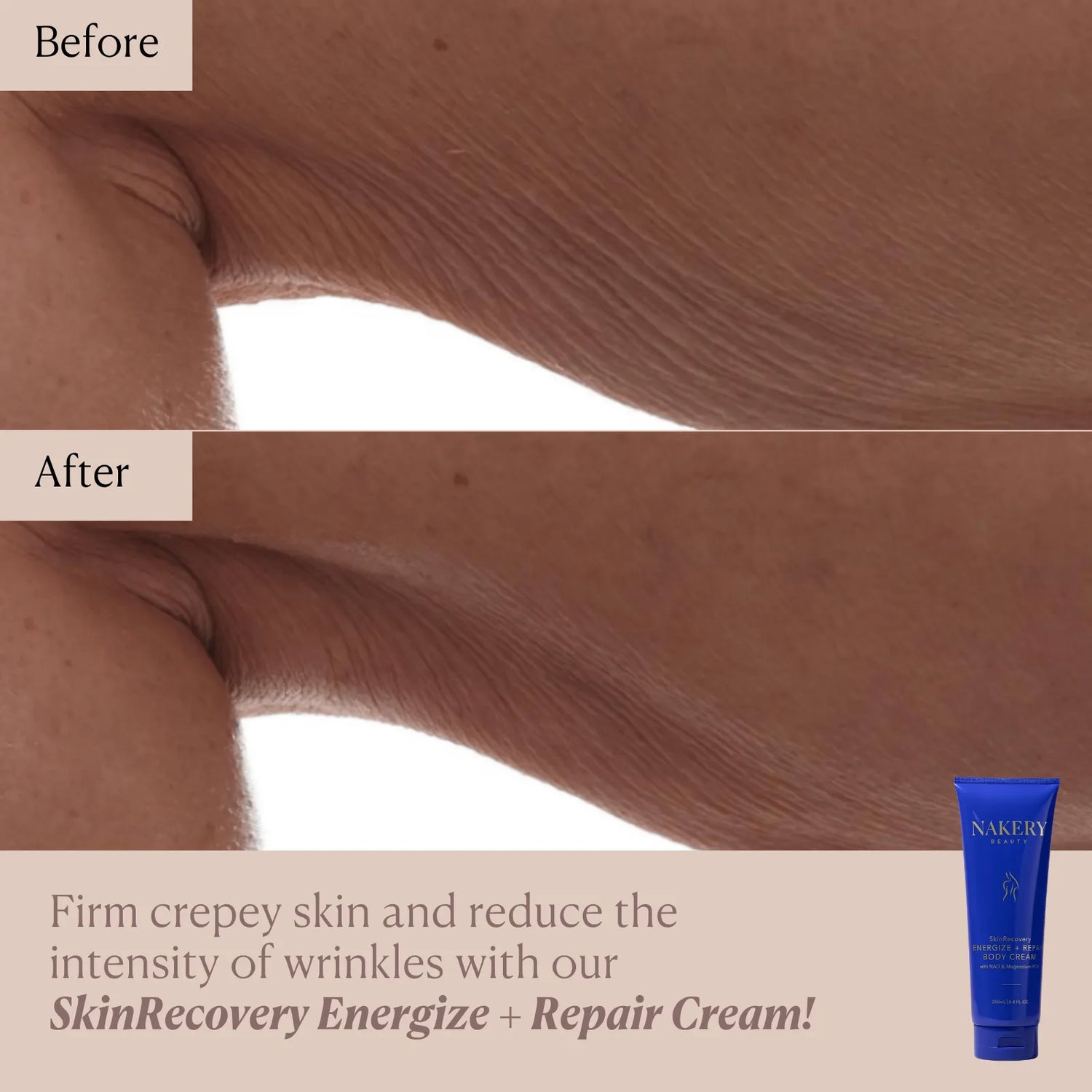 SkinRecovery Energize + Repair Body Cream