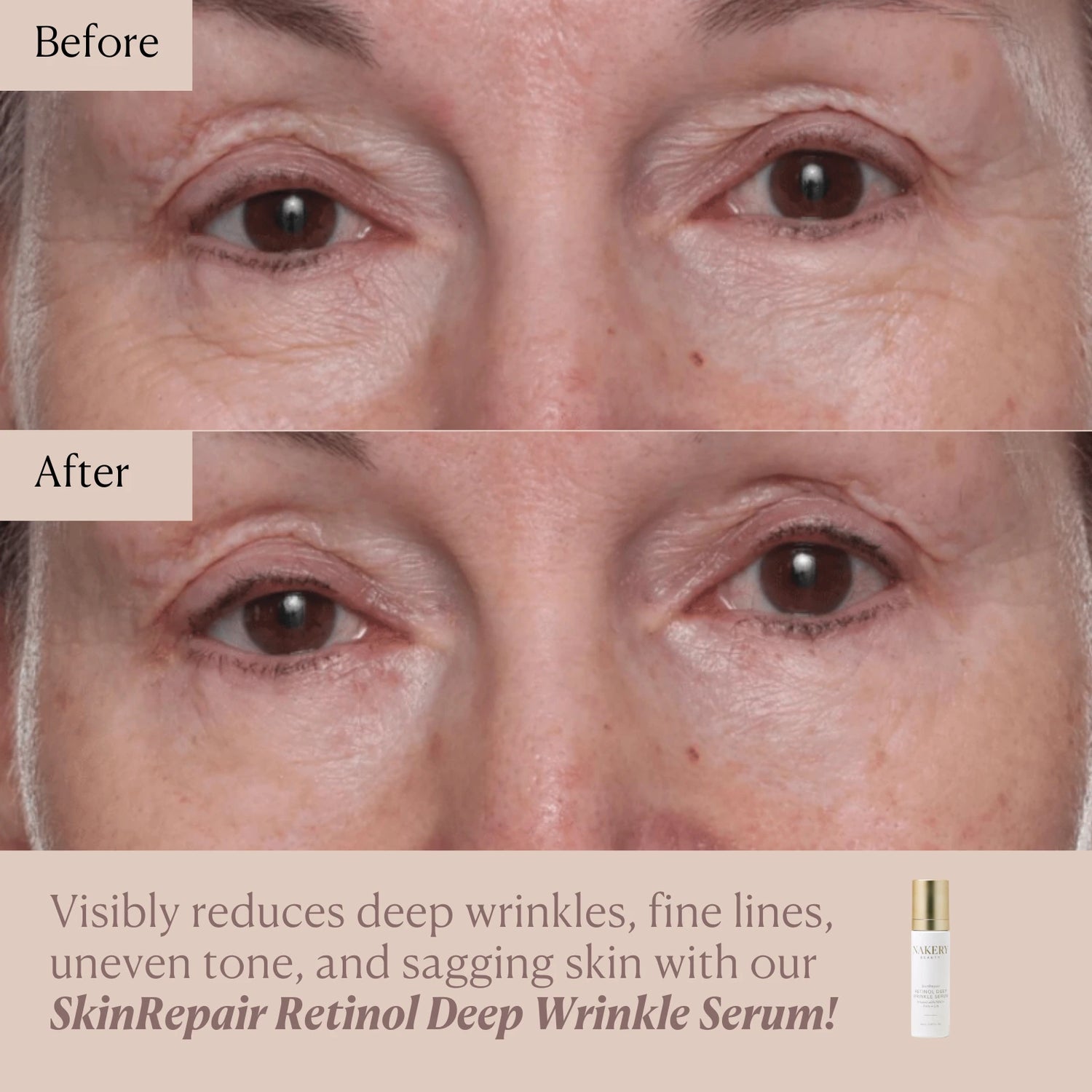 SkinRepair Retinol Deep Wrinkle Serum