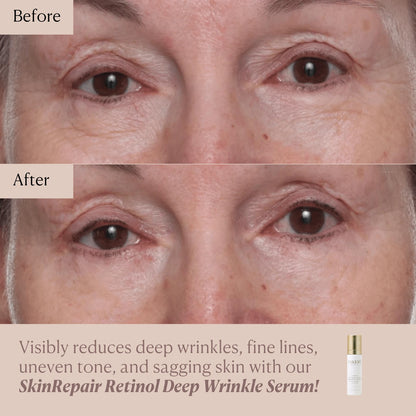 SkinRepair Retinol Deep Wrinkle Serum