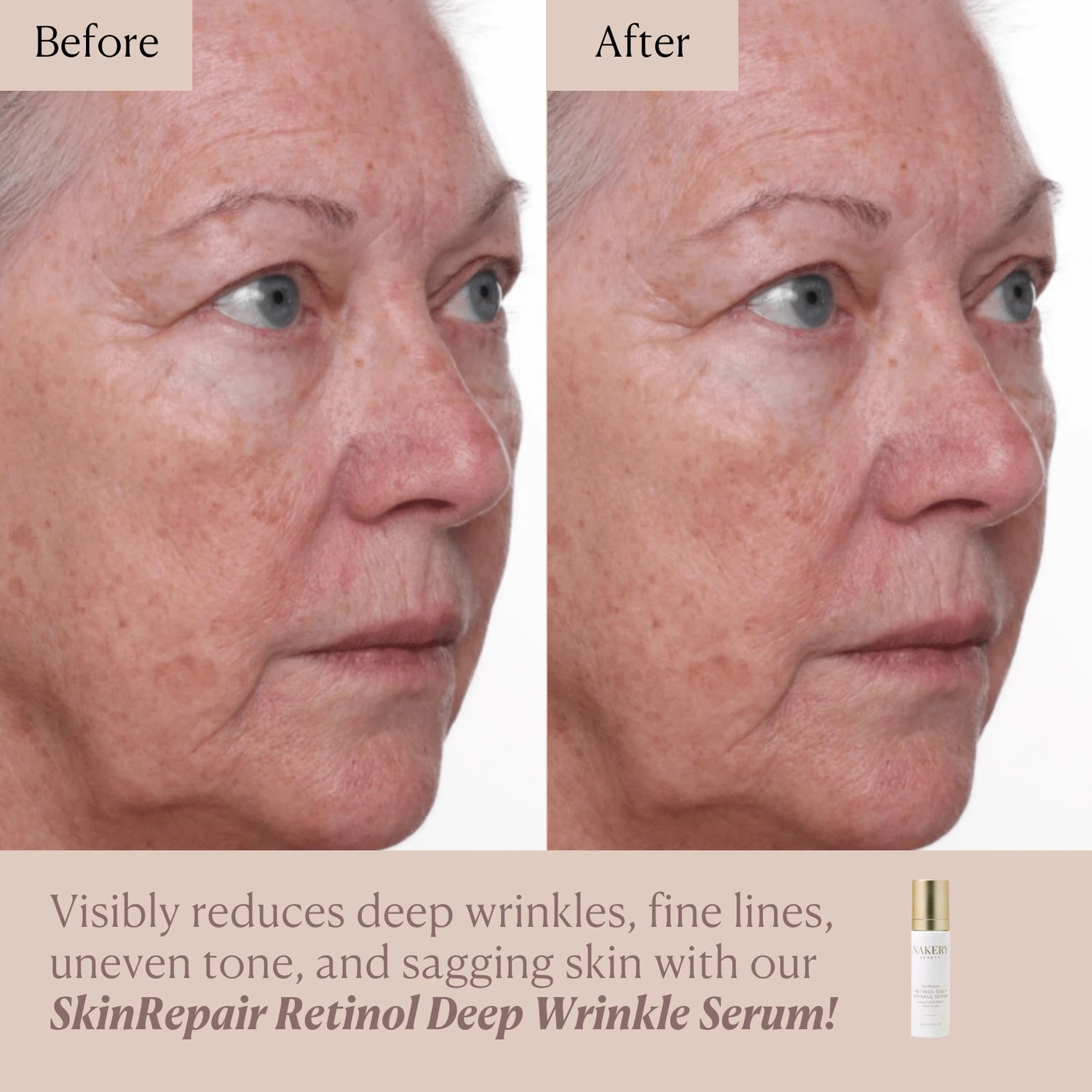 SkinRepair Retinol Deep Wrinkle Serum