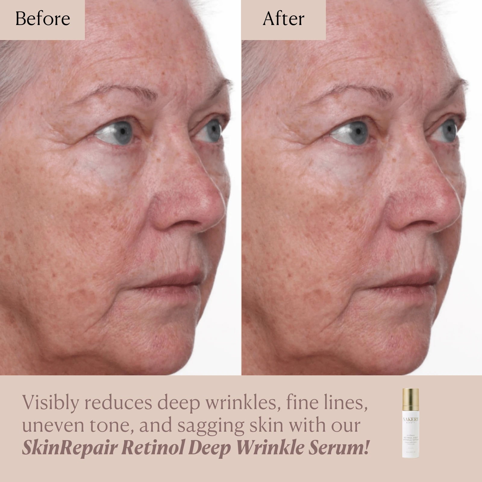 SkinRepair Retinol Deep Wrinkle Serum