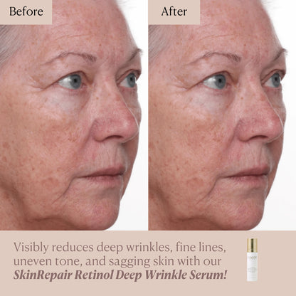 SkinRepair Retinol Deep Wrinkle Serum