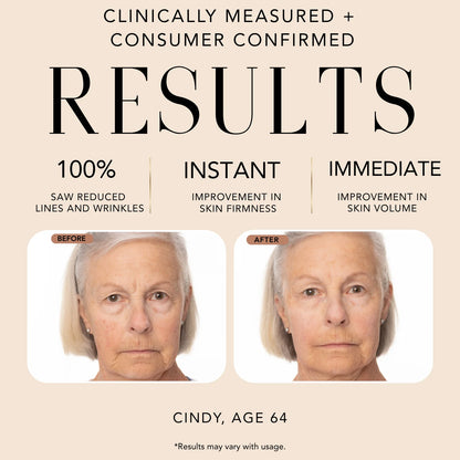 Before-and-after comparison showing clinically measured results from Nakery Beauty Power Blend Elixir Serum, including reduced lines and wrinkles and improved skin firmness and volume.