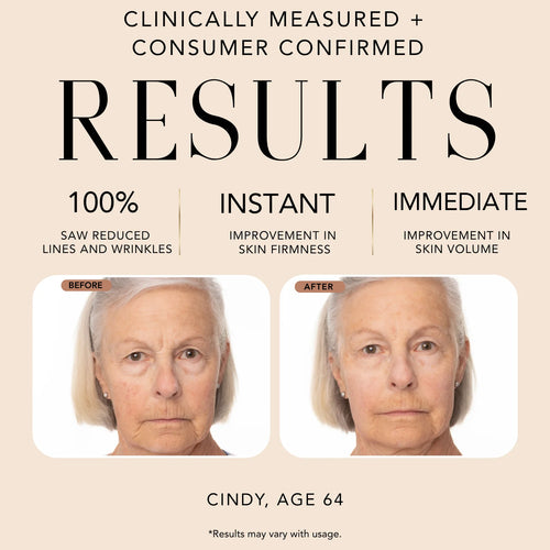 Before-and-after comparison showing clinically measured results from Nakery Beauty Power Blend Elixir Serum, including reduced lines and wrinkles and improved skin firmness and volume.