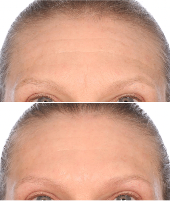 SkinRepair Double Retinol + Collagen Face & Body Treatment